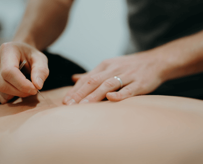 Active Release Technique